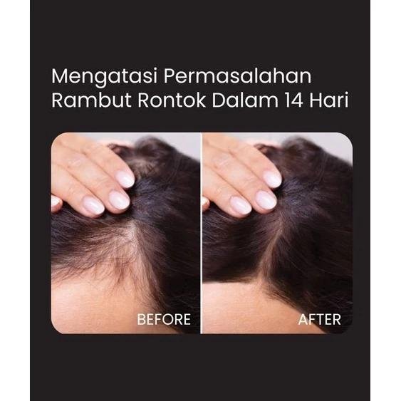 Energizing Miracle Shampoo 250ml - gambar 4
